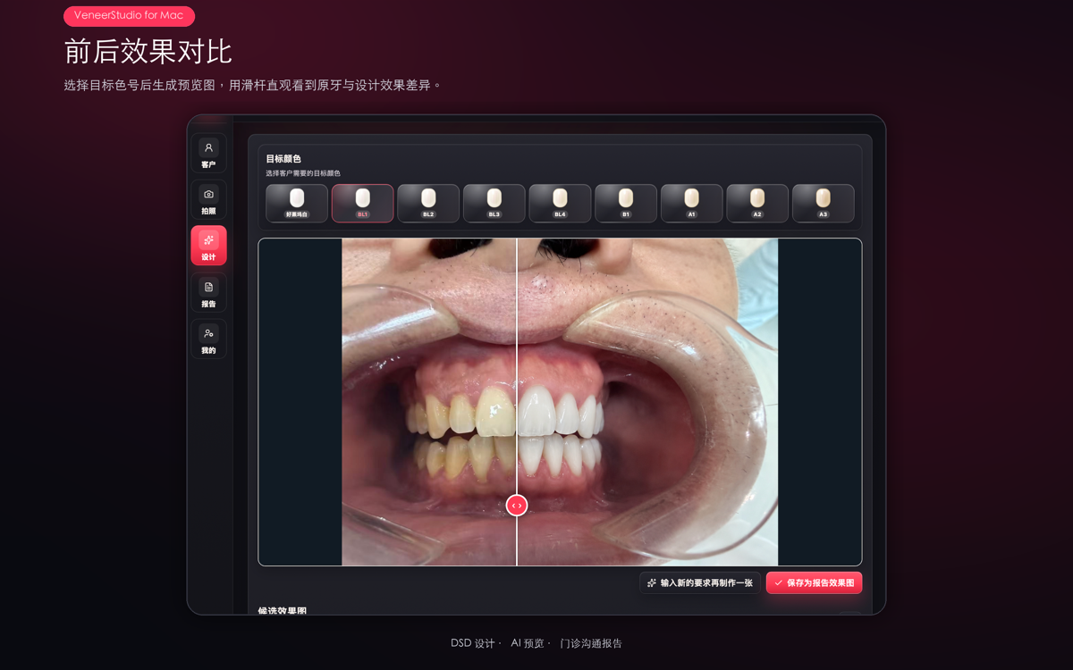 VeneerStudio 美学预览界面示意